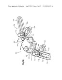 Spinal Access Retractor diagram and image