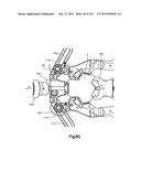 Spinal Access Retractor diagram and image