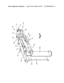 Spinal Access Retractor diagram and image