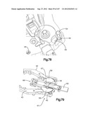 Spinal Access Retractor diagram and image