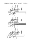 Spinal Access Retractor diagram and image