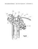 Spinal Access Retractor diagram and image