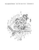 Spinal Access Retractor diagram and image