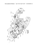 Spinal Access Retractor diagram and image