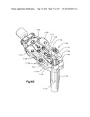 Spinal Access Retractor diagram and image