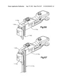 Spinal Access Retractor diagram and image