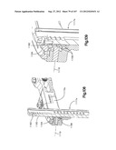 Spinal Access Retractor diagram and image