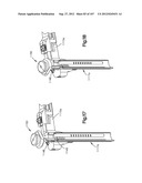 Spinal Access Retractor diagram and image