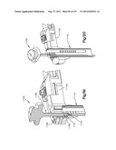 Spinal Access Retractor diagram and image