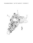 Spinal Access Retractor diagram and image