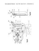 Spinal Access Retractor diagram and image