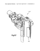 Spinal Access Retractor diagram and image