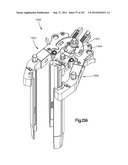 Spinal Access Retractor diagram and image