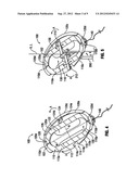 Thoracic Access Port Including Foldable Anchor diagram and image