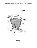 Thoracic Access Port Including Foldable Anchor diagram and image