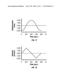 Glucose Monitoring System diagram and image