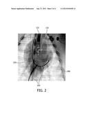 COMBINATION OF ULTRASOUND AND X-RAY SYSTEMS diagram and image