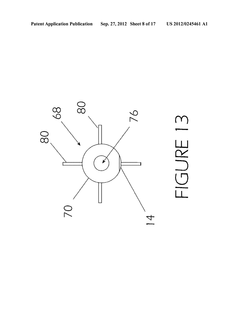 Therapeutic Inflatable Occlusive Devices, Systems, and Methods for     Multiple Sclerosis, Deep Vein Thrombosis, and Pulmonary Embolism - diagram, schematic, and image 09