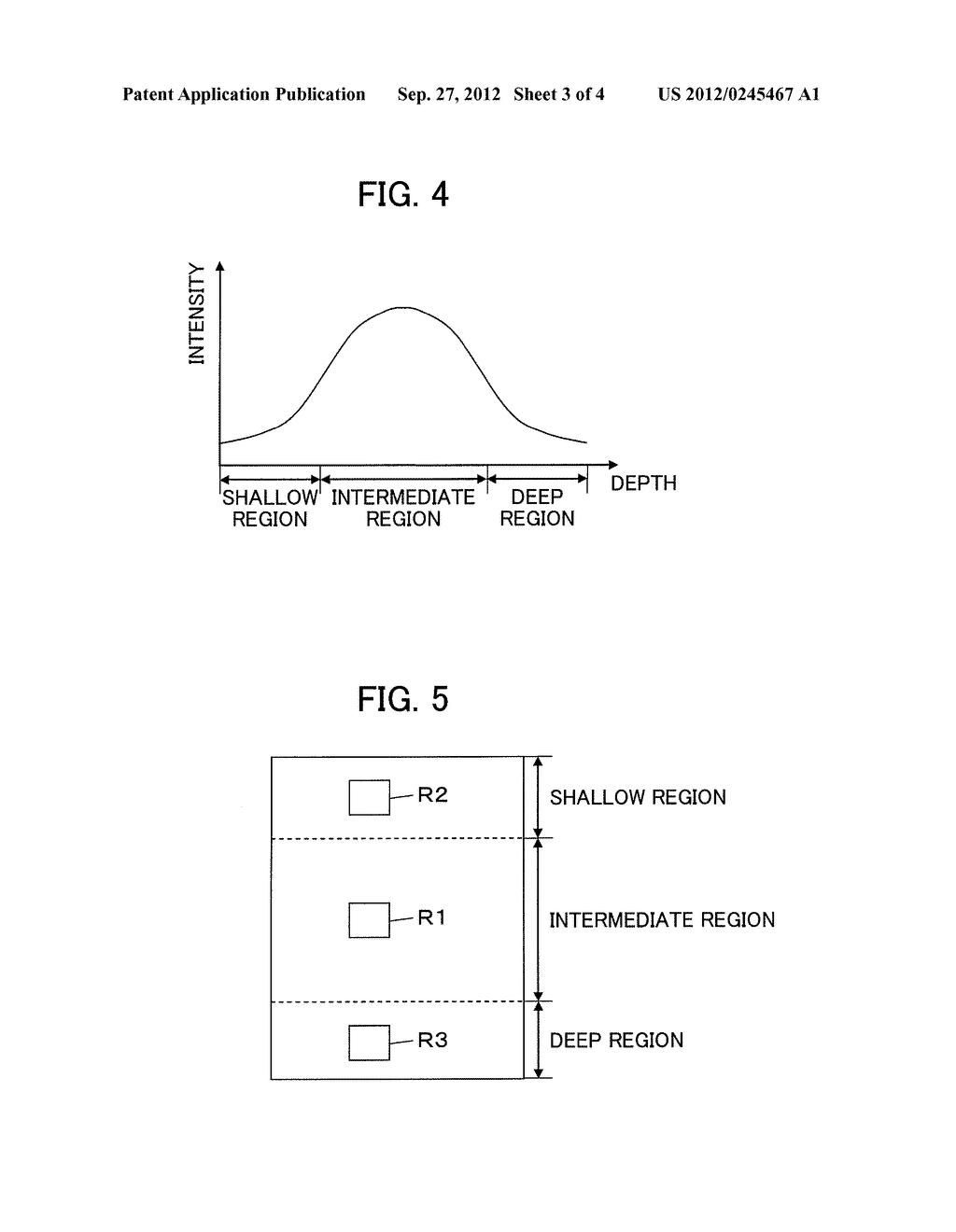 ULTRASOUND DIAGNOSTIC APPARATUS AND ULTRASOUND IMAGE PRODUCING METHOD - diagram, schematic, and image 04