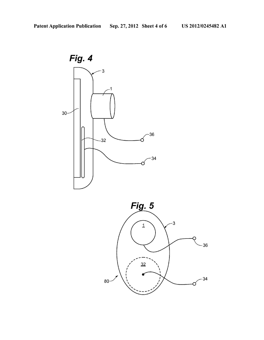 Anesthesia Monitoring Device and Method - diagram, schematic, and image 05