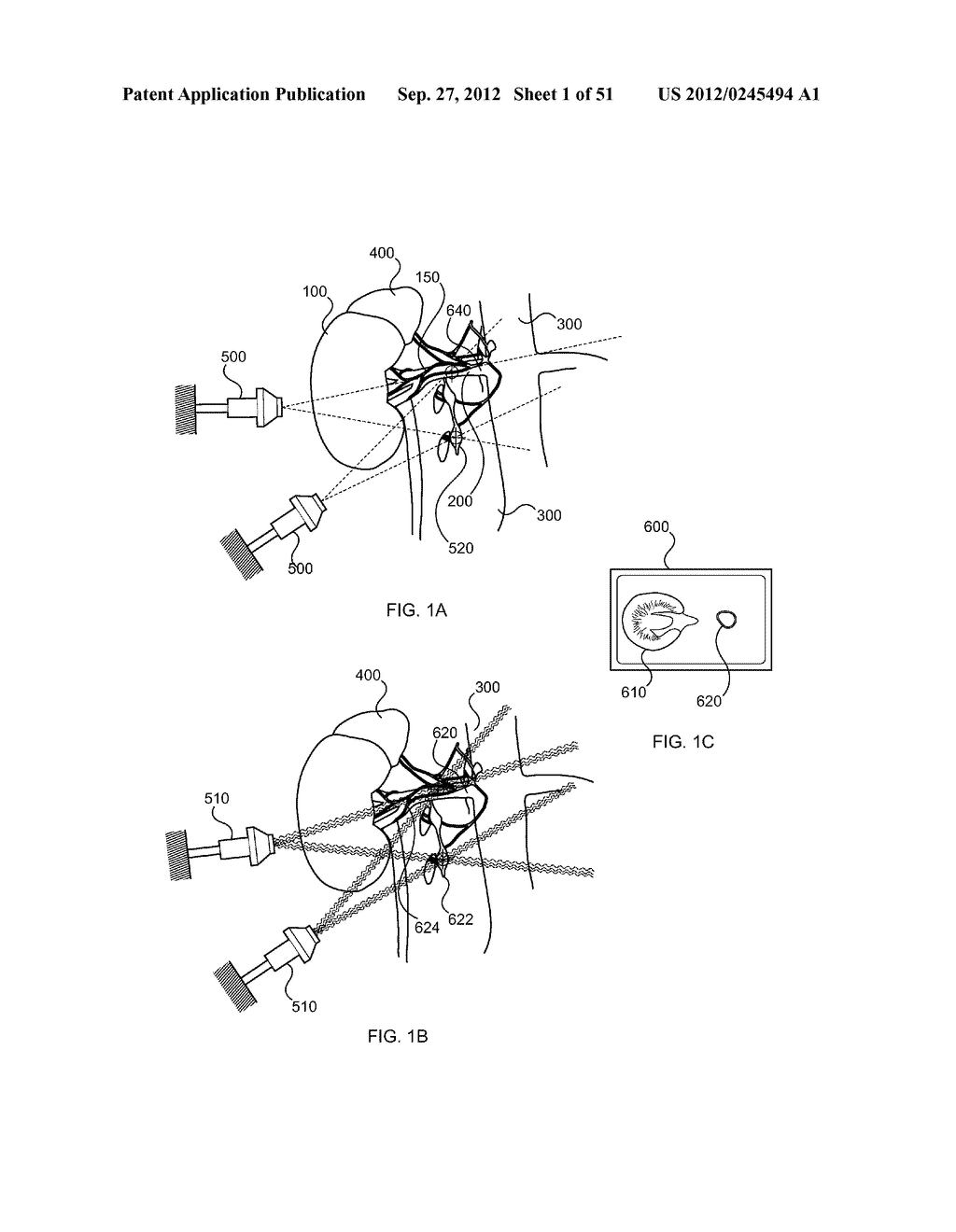 METHODS FOR TREATMENT USING ULTRASONIC ENERGY - diagram, schematic, and image 02