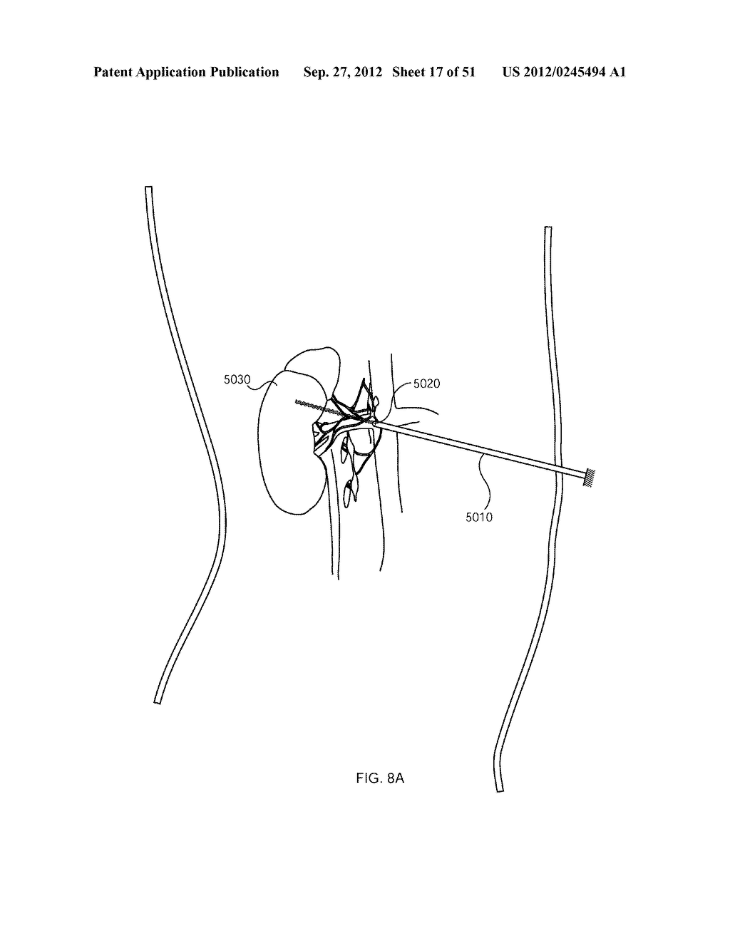 METHODS FOR TREATMENT USING ULTRASONIC ENERGY - diagram, schematic, and image 18