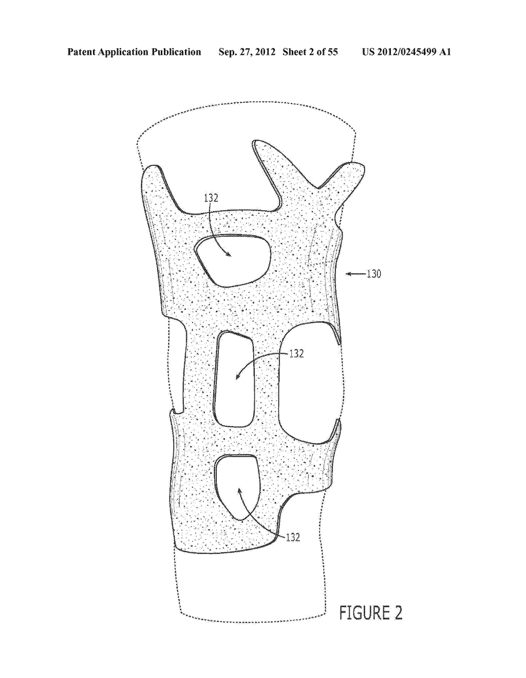 DONNING POTENTIATING SUPPORT WITH EXPANDABLE FRAMEWORK FASTENED TO GARMENT - diagram, schematic, and image 03