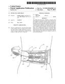 Double Pull Body Brace diagram and image