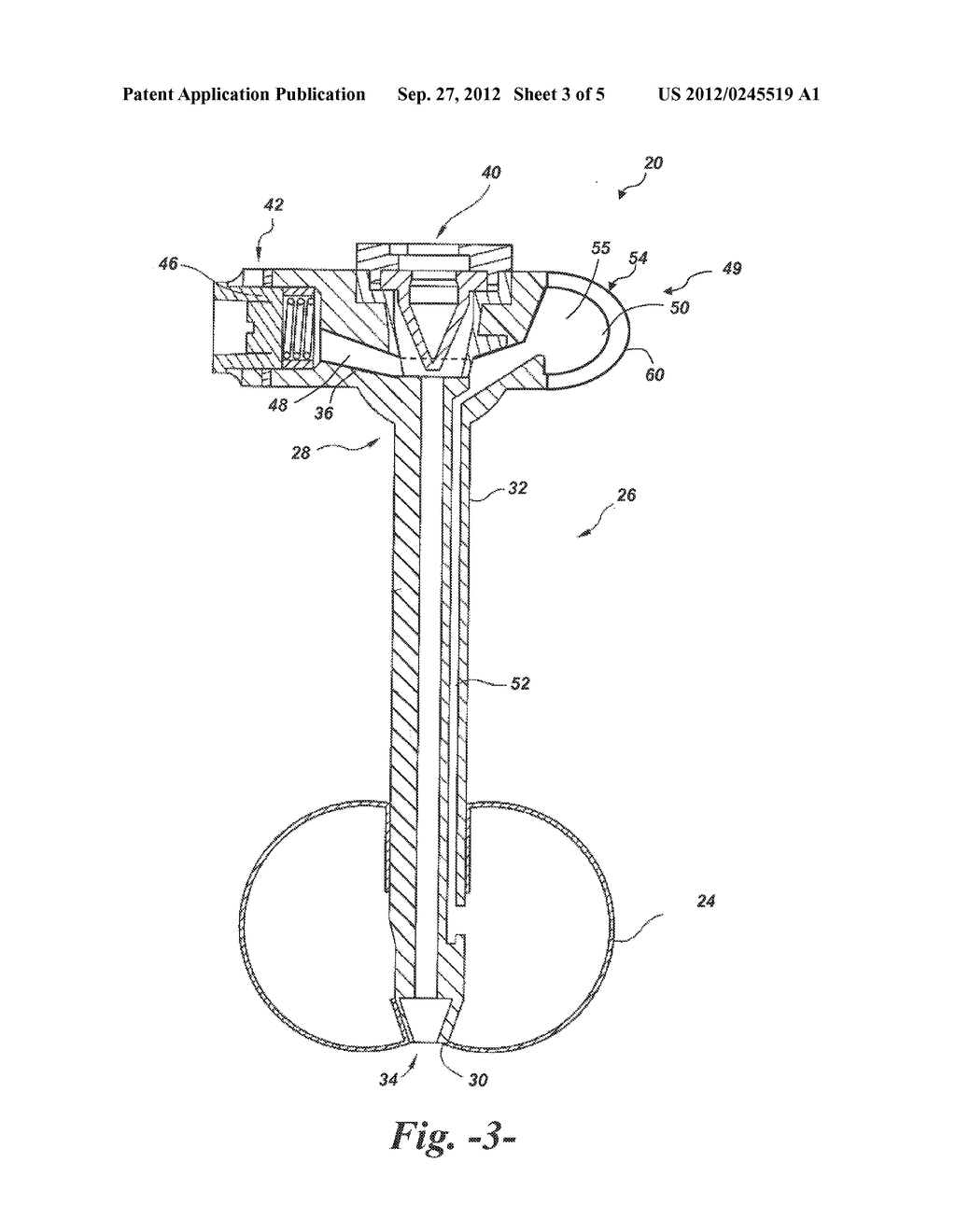 Enteral Feeding Catheter Device with an Indicator - diagram, schematic, and image 04