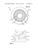 Reinforced Balloon Catheter diagram and image