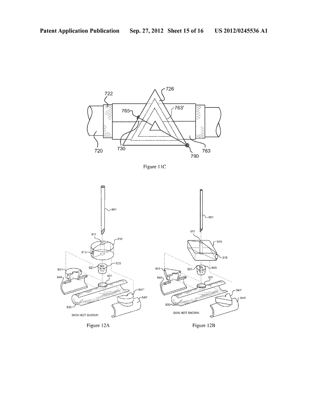 IMPLANTABLE VASCULAR ACCESS SYSTEM - diagram, schematic, and image 16