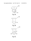 LACRIMAL IMPLANTS INCLUDING SPLIT AND INSERTABLE DRUG CORE diagram and image