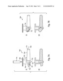 LACRIMAL IMPLANTS INCLUDING SPLIT AND INSERTABLE DRUG CORE diagram and image