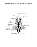 INTRAVENTRICULAR DRUG DELIVERY SYSTEM FOR IMPROVING OUTCOME AFTER A BRAIN     INJURY AFFECTING CEREBRAL BLOOD FLOW diagram and image