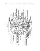 INTRAVENTRICULAR DRUG DELIVERY SYSTEM FOR IMPROVING OUTCOME AFTER A BRAIN     INJURY AFFECTING CEREBRAL BLOOD FLOW diagram and image