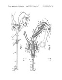 SURGICAL INSTRUMENT diagram and image