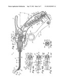 SURGICAL INSTRUMENT diagram and image