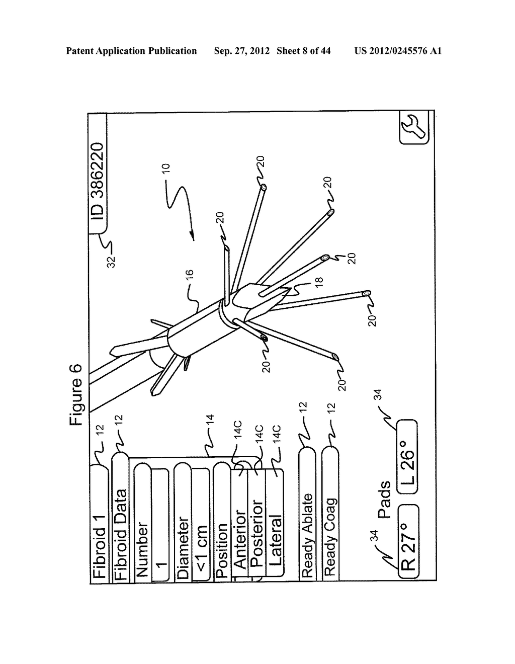 MERGED IMAGE USER INTERFACE AND NAVIGATIONAL TOOL FOR REMOTE CONTROL OF     SURGICAL DEVICES - diagram, schematic, and image 09