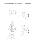 Welded Looped Suture diagram and image