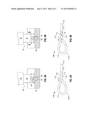 Welded Looped Suture diagram and image