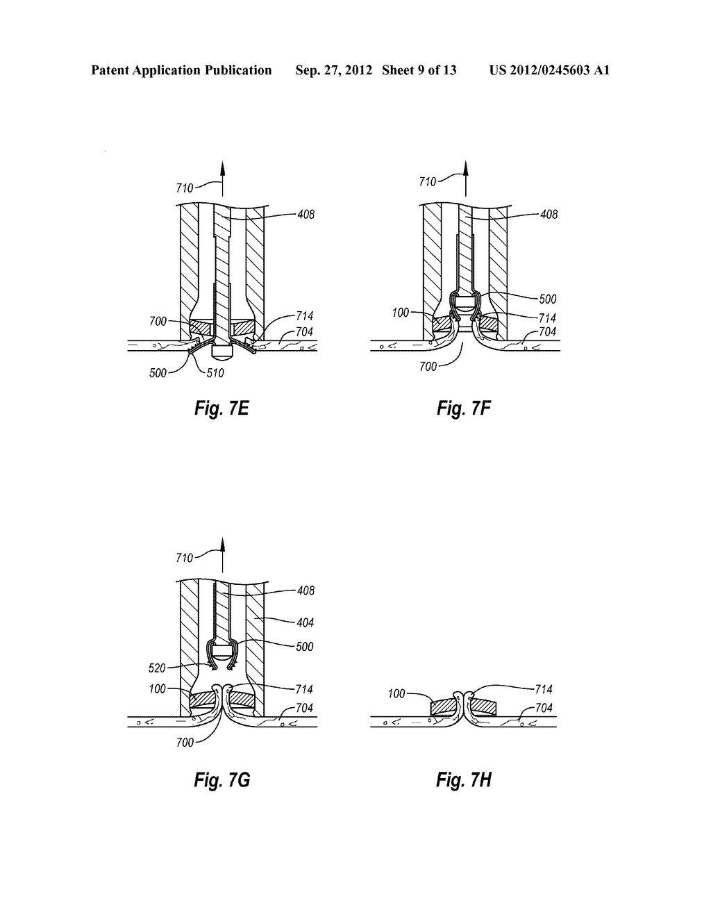 CLIP FOR TISSUE CLOSURE - diagram, schematic, and image 10