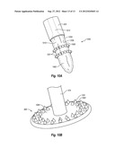 CLIP FOR TISSUE CLOSURE diagram and image