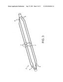 Balloon Catheter With Non-Deployable Stent diagram and image