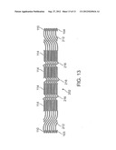 Balloon Catheter With Non-Deployable Stent diagram and image