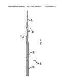 System And Method Of Detecting Implant Detachment diagram and image