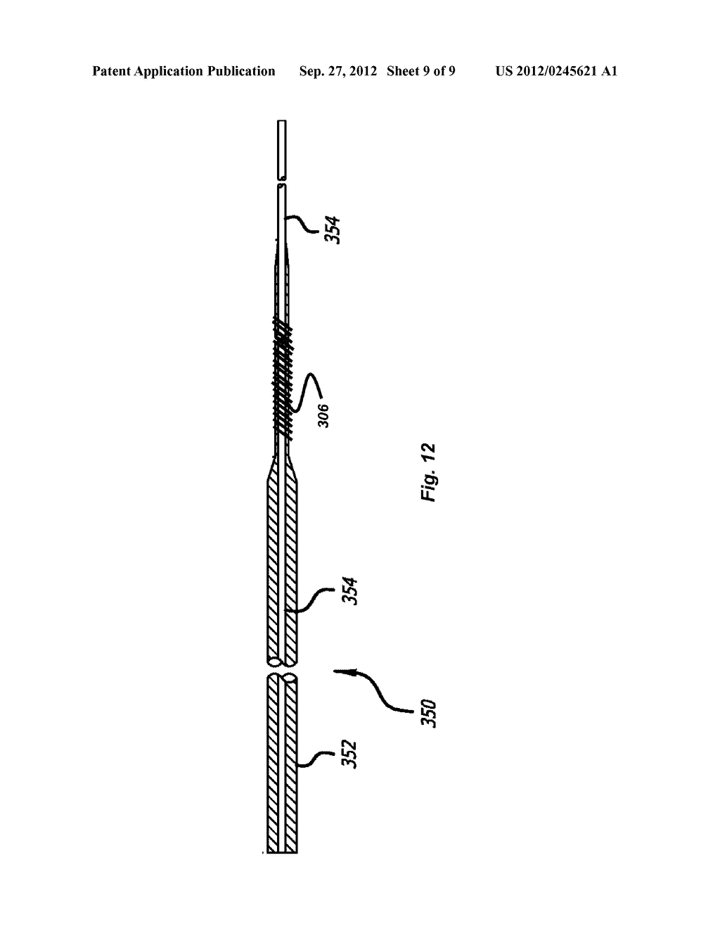 System And Method Of Detecting Implant Detachment - diagram, schematic, and image 10