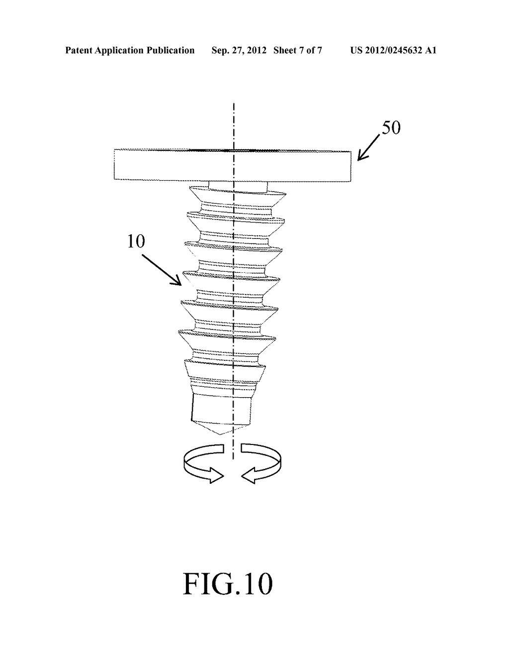 BONE ANCHOR - diagram, schematic, and image 08