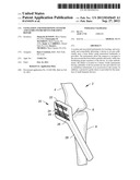 NAVIGATION AND POSITIONING SYSTEMS AND GUIDE INSTRUMENTS FOR JOINT REPAIR diagram and image