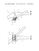 NAVIGATION AND POSITIONING SYSTEMS AND GUIDE INSTRUMENTS FOR JOINT REPAIR diagram and image