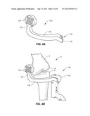 NAVIGATION AND POSITIONING SYSTEMS AND GUIDE INSTRUMENTS FOR JOINT REPAIR diagram and image